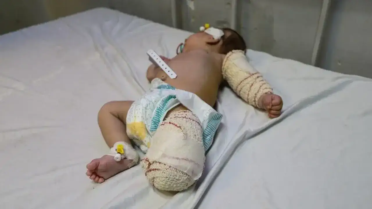 Gazze’de binlerce hasta için sınır kapılarının açılması çağrısı